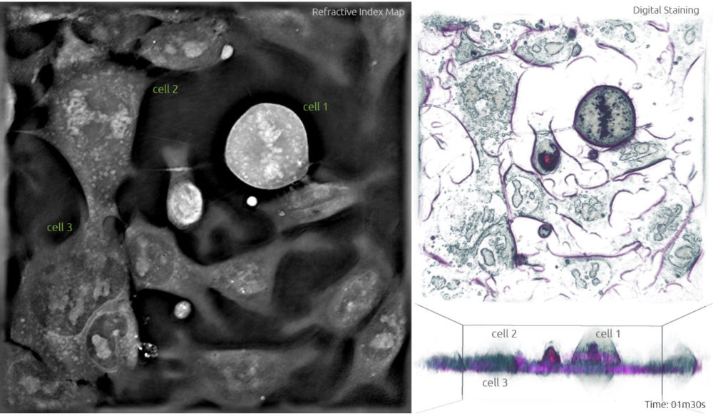 Stem cells undergoing mitosis - label-free live cell imaging