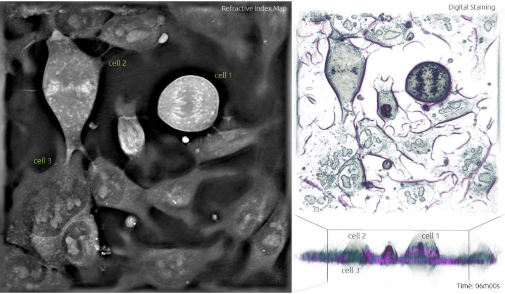 Stem Cells undergoing mitosis (anaphase) - label-free live cell imaging