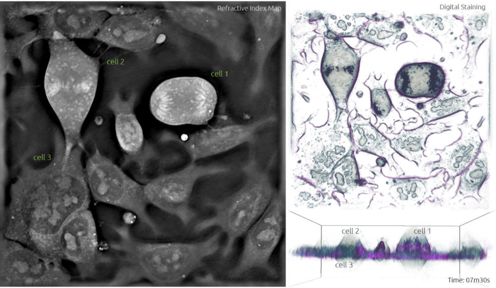 Stem Cells undergoing mitosis - label-free live cell imaging